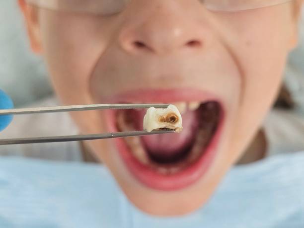 Best Emergency Dental Care for Trauma or Injury in Thunderbolt, GA